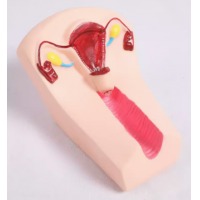 YX/B3女性宫内避孕器及训练模型