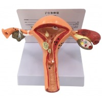 人体子宫模型教具